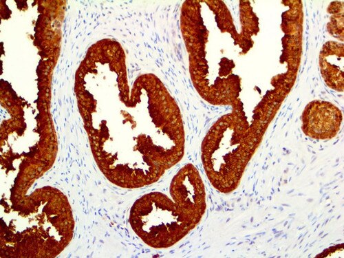 IHC of PSP94 / MSMB on an FFPE Prostate Tissue